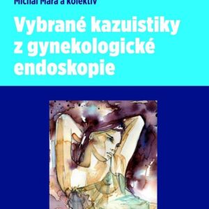 Vybrané kazuistiky z gynekologické endoskopie (Doc.MUDr. Michal Mára) (česky)