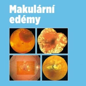 Makulární edémy (MUDr. Jan Ernest) (česky)