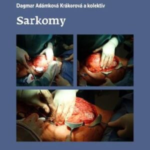 Sarkomy (Dagmar Adámková Krákorová) (česky)
