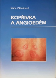 Kopřivka a angioedém (Marie Viktorinová) (česky)