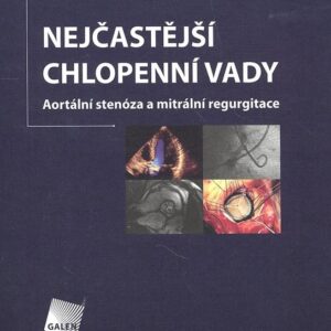 Nejčastější chlopenní vady - Aortální stenóza a mitrální regurgitace (Roman Čerbák) (česky)