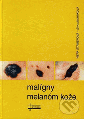 Malígny malanóm kože (Viera Strmeňová)