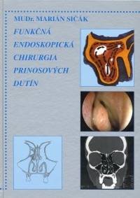 Funkčná endoskopická chirurgia prínosových dutín (Marián Sičák)